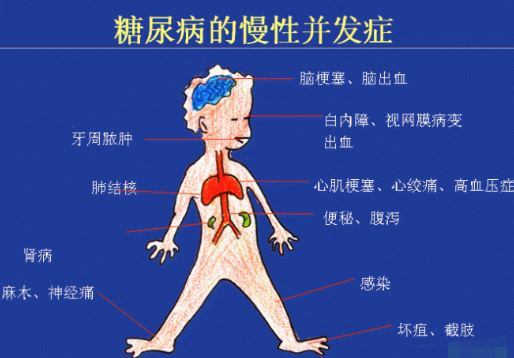 你還在害怕高血糖嗎？科學(xué)補(bǔ)硒不“恐糖”